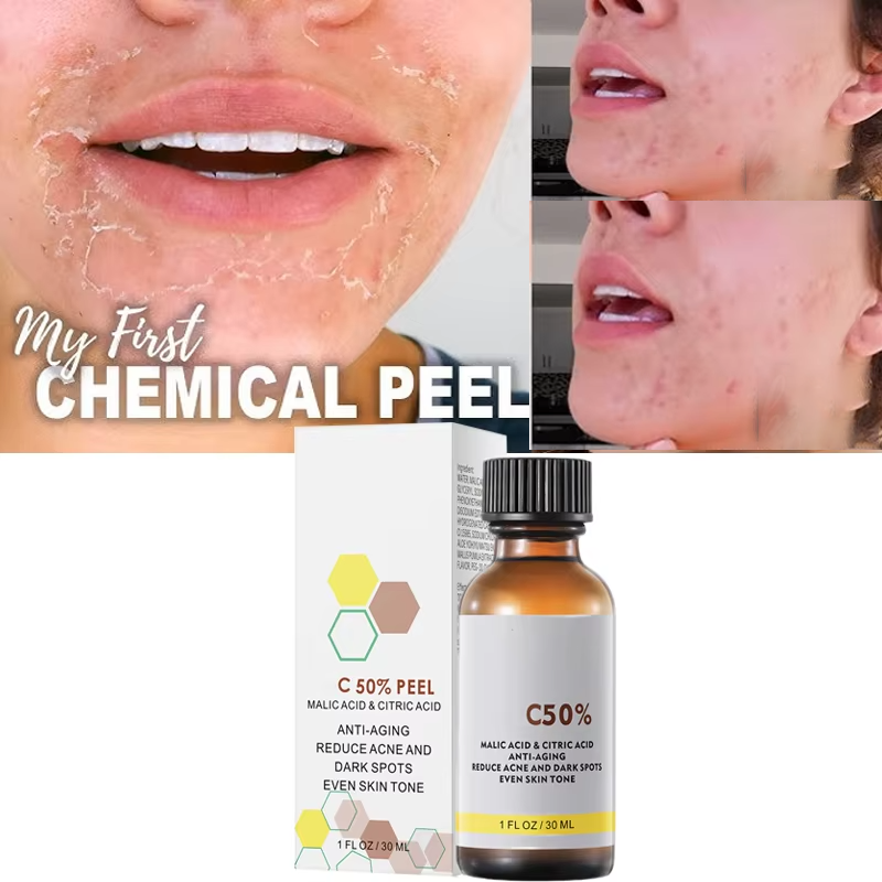 Salicylic Acid Cleanser - 사과산과 구연산 함유 40% 필링 세럼,