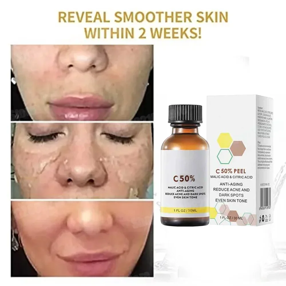 살리실산 페이스 페이셜 필 중화제 페이스 딥 홈 케미컬 - Salicylic Acid Cleanser 리뷰 및 가격