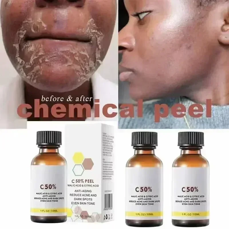 살리실산 페이스 페이셜 필 중화제 페이스 딥 홈 케미컬 - Salicylic Acid Cleanser 리뷰 및 가격