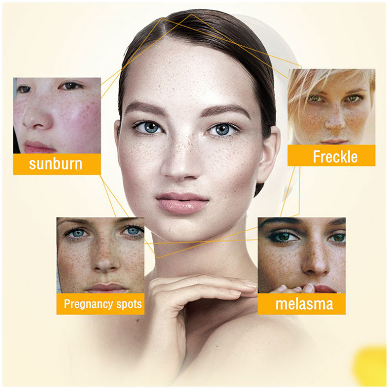 Dimollaure-미백 주근깨 보습 크림, 퍼밍, 주 - Skincare Korea 리뷰 및 가격