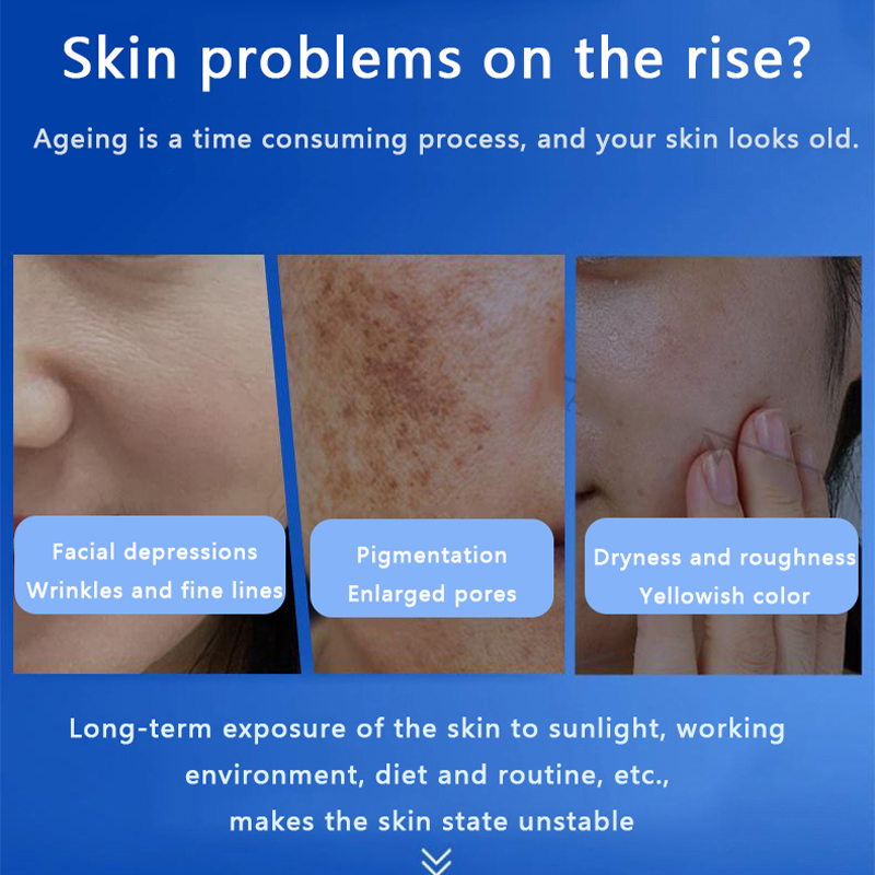 페이스 블루 스펀지 미세조류 스킨 부스터 스킨케어 키트 - Hyaluronic Acid Serum 리뷰 및 가격